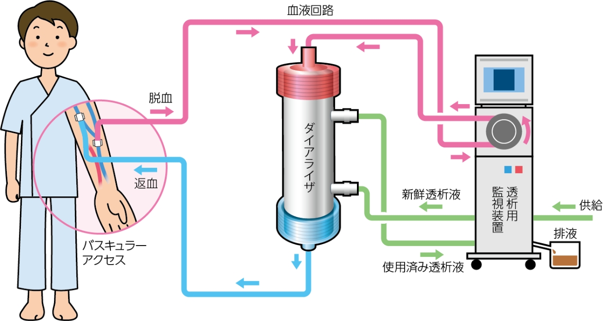 透析室 イメージ