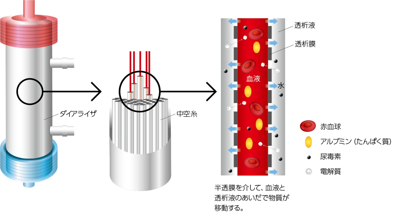 透析室 イメージ